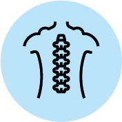 Tumor cervical